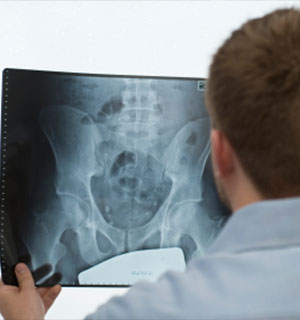 Osteoporosis Treatment in Annapolis, MD