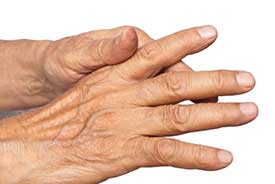 Trigger Finger Treatment in Ozona, FL