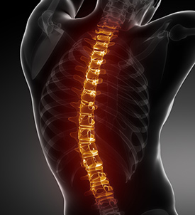Minimally-Invasive Spine Surgery in Saddle River, NJ